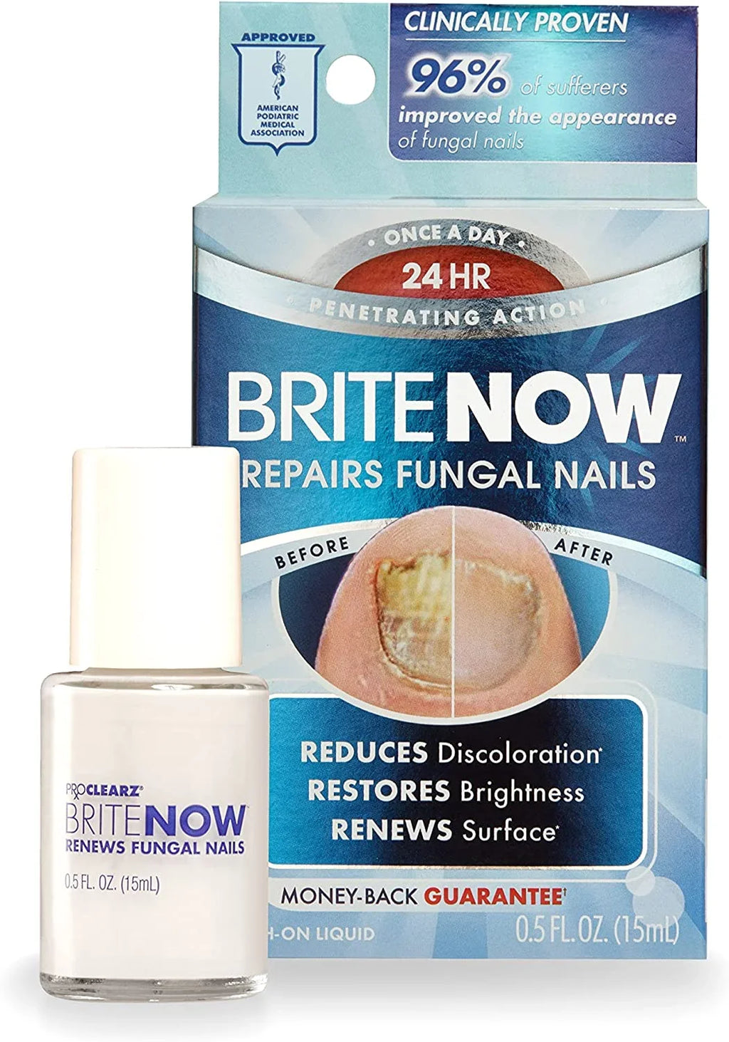 ProClearz Brite Now Nail Treatment, Restores The Appearance Of Damaged & Discolored Nails, Peel-Away Technology, Brightening & Smoothing Nail Repair, 0.5 Ounce